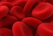 آنچه در مورد کم خونی باید بدانید